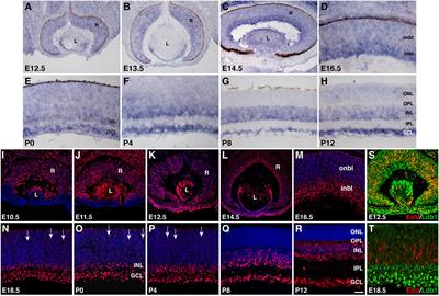 Necessity and Sufficiency of Ldb1 in the Generation, Differentiation and Maintenance of Non-photoreceptor Cell Types During Retinal Development